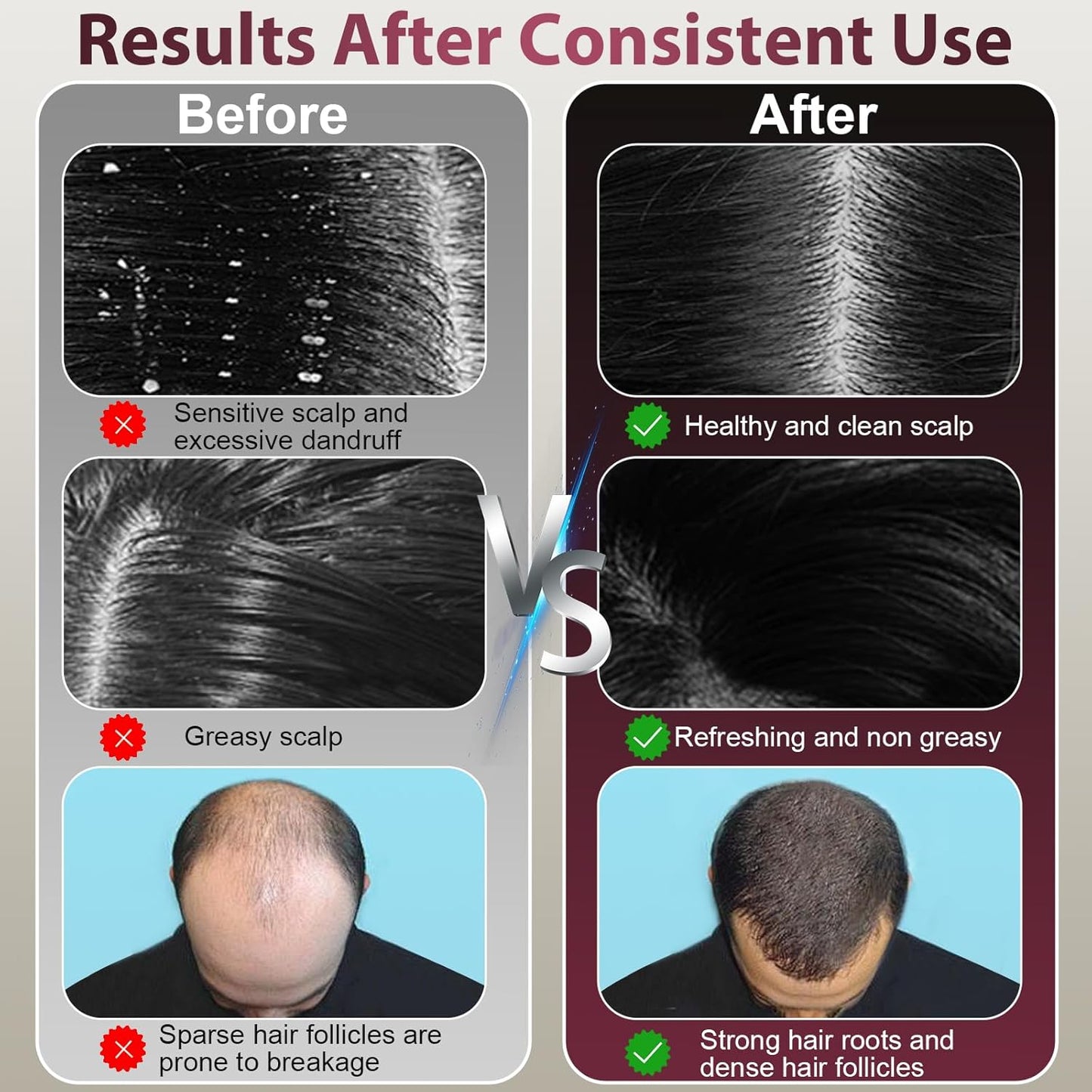 HairGlow Pro